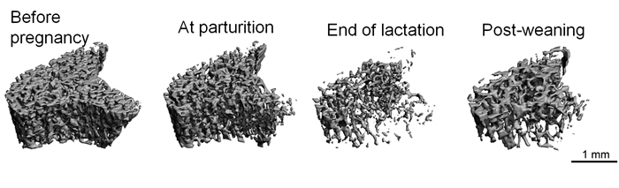 Longitudinal changes in the trabecular bone