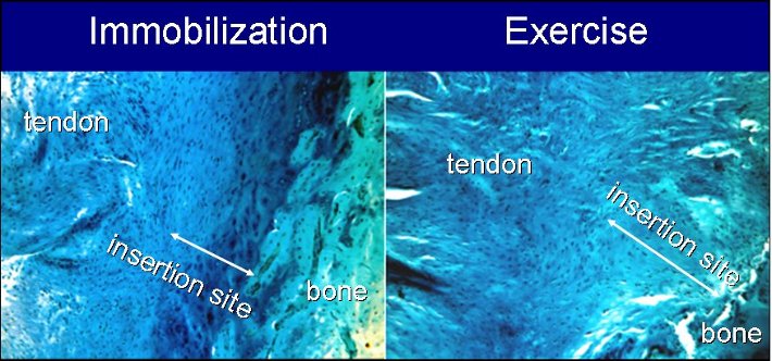 tendon to bone insertion site diagram