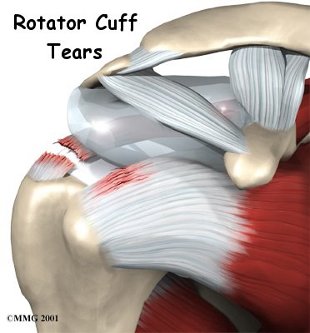 shoulder rotator cuff