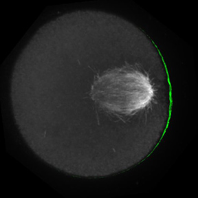 Mitotic spindle assembly