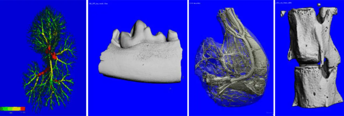 images of bones and tissue