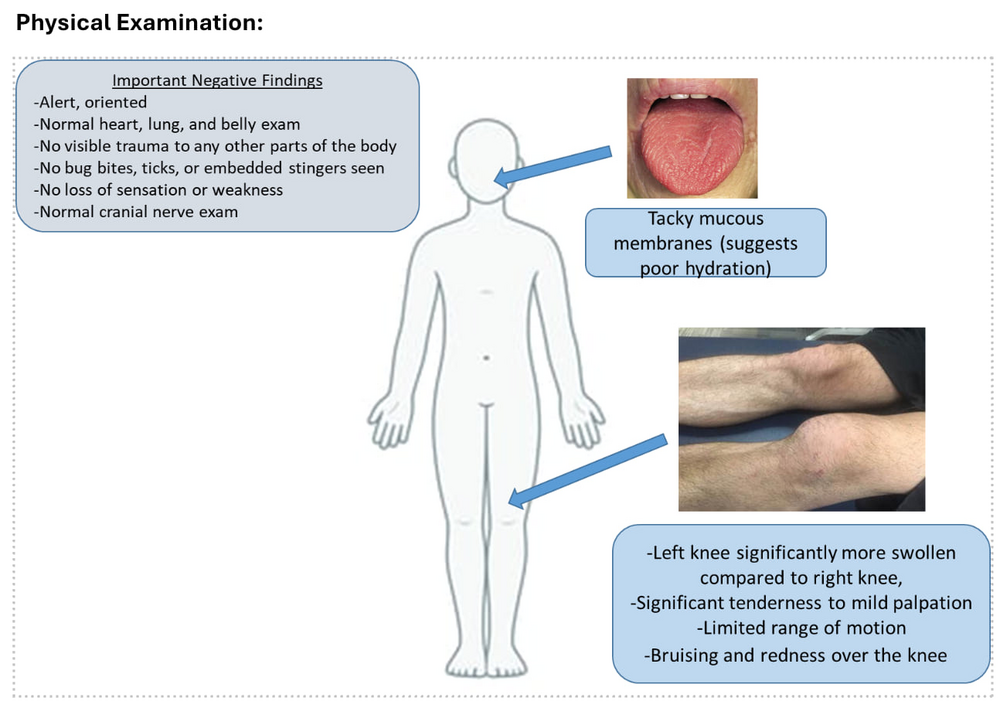 Diagram of a child with exam findings showing tacky mucous membranes and a swollen, tender, bruised knee, alongside normal systemic exam findings.
