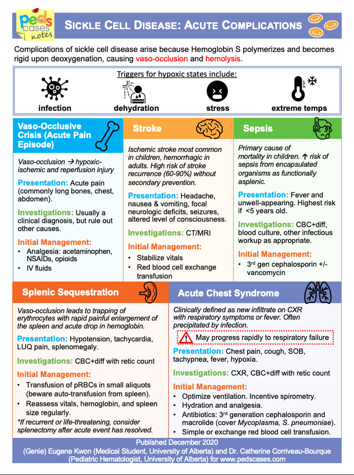 A summary of acute complications in sickle cell disease, including triggers and key presentations, investigations, and management for VOC, stroke, sepsis, splenic sequestration, and acute chest syndrome.