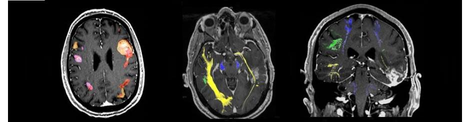 axial coronal sagittal