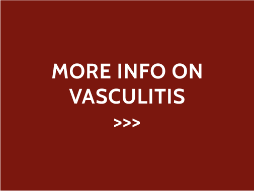 go to see more info on vasculitis