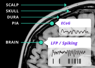A brain-machine interface records neural activity from the brain and processes it to generate a control signal.