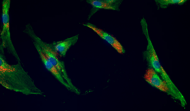 Cultured human airway smooth cells stained for Β₂ Adrenergic Receptor and LAMP-1. 