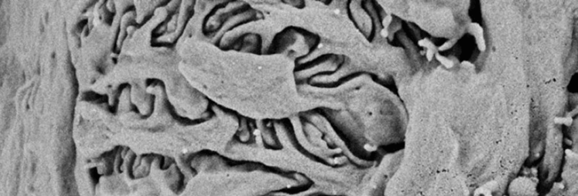 Glomerulus microscopy