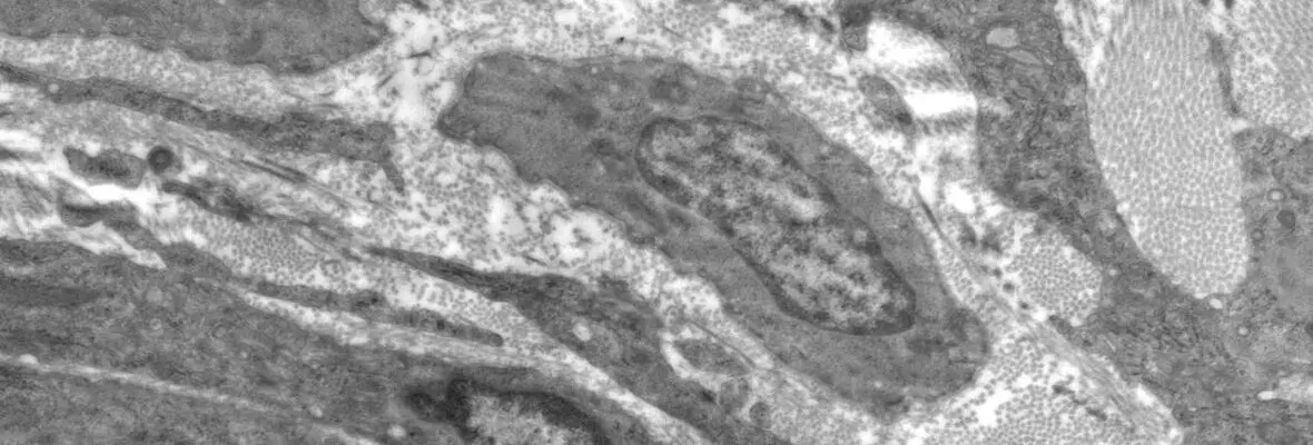 Electron microscopy picture showing the intestinal mesenchyme