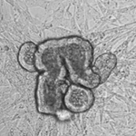 organoids
