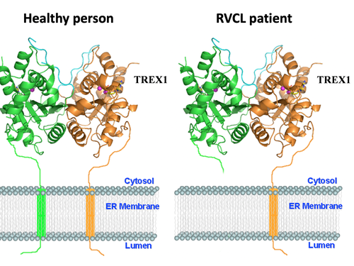 TREX1 in healthy and RVCL