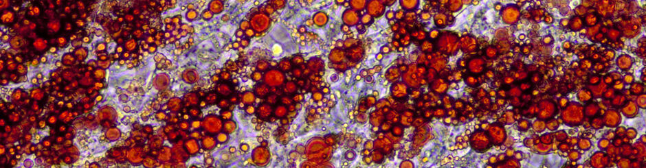 Oil Red O-stained cultured human adipocytes