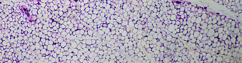 Mouse inguinal fat, H&E