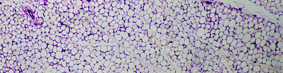 Mouse inguinal fat, H&E