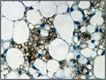 UCP1 IHC staining of beige adipocytes in a white adipose depot
