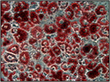 Lipid droplets in cultured mouse adipocytes stained red with Oil Red O