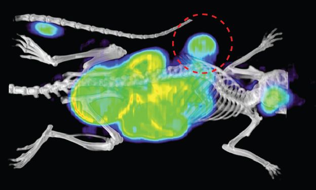 PET imaging demonstrates localization of carbon-11 labeled trimethoprim to a tumor expressing bacterial DHFR.