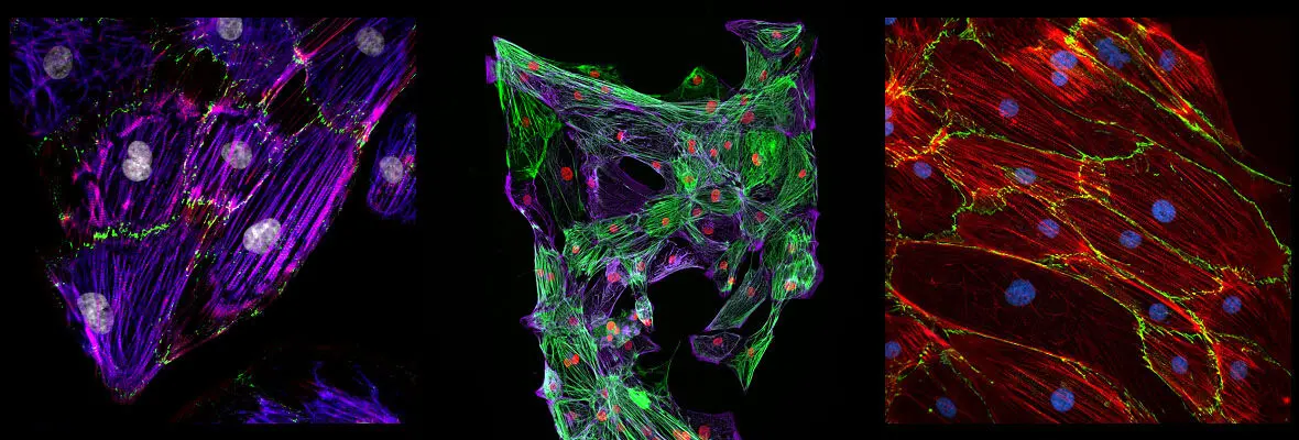 Three scientific images of heart muscle.