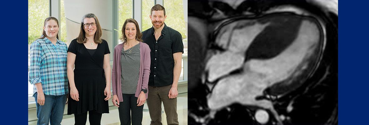 Four lab members standing together on the left; a separate image of a black and white echo of a heart on the right.