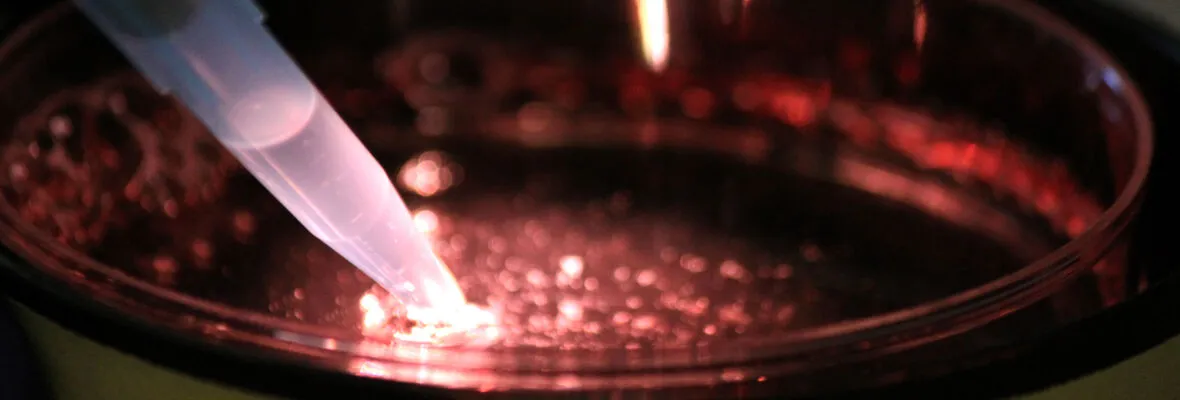 Cell culture in dish