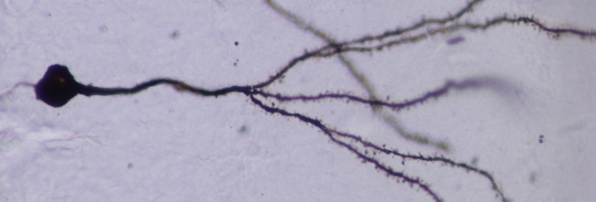 Neuron Golgi Stain