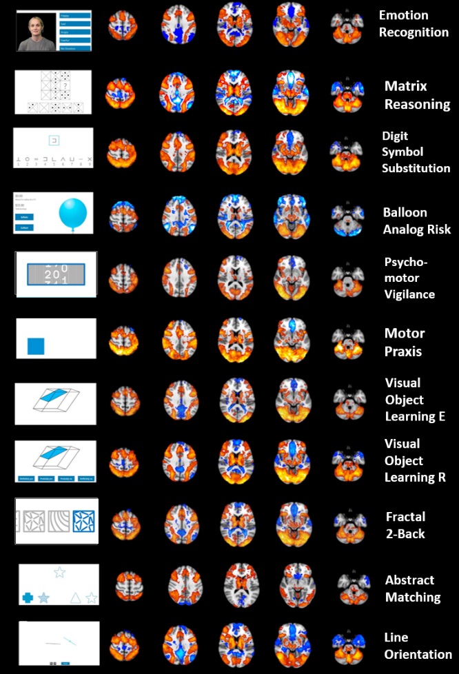 MRI scans showing cerebral networks recruited by each Cognition test