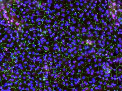 A vibrant scientific photo including maroon, lime green, and black depiction of cells pictured by a powerful microscope.