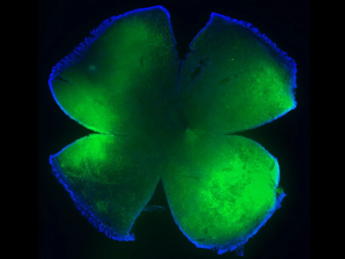 A green, maroon, and black figure is visible within a photo taken by a powerful microscope, depicting scaled genetic material up close.