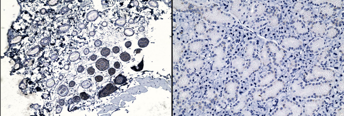 Stained tissue slices