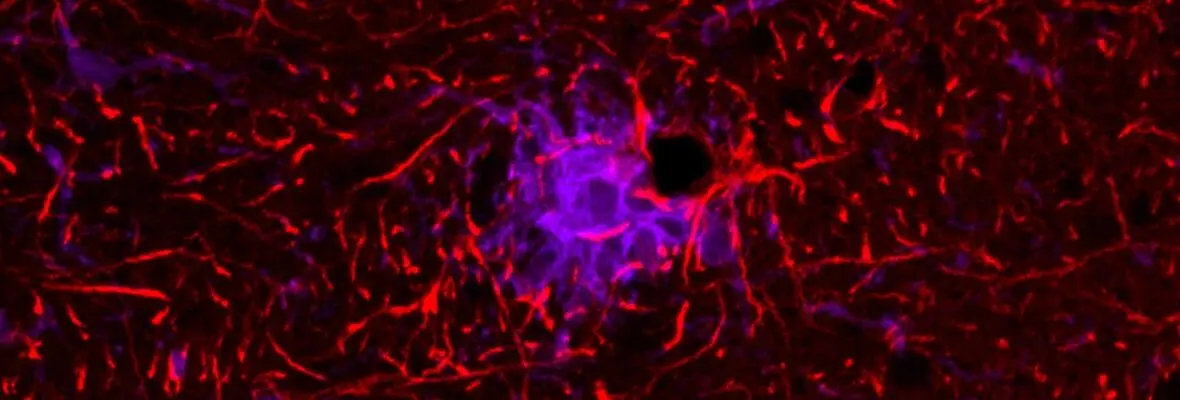 Looking at the pathology of a cell to better understand it's biology.