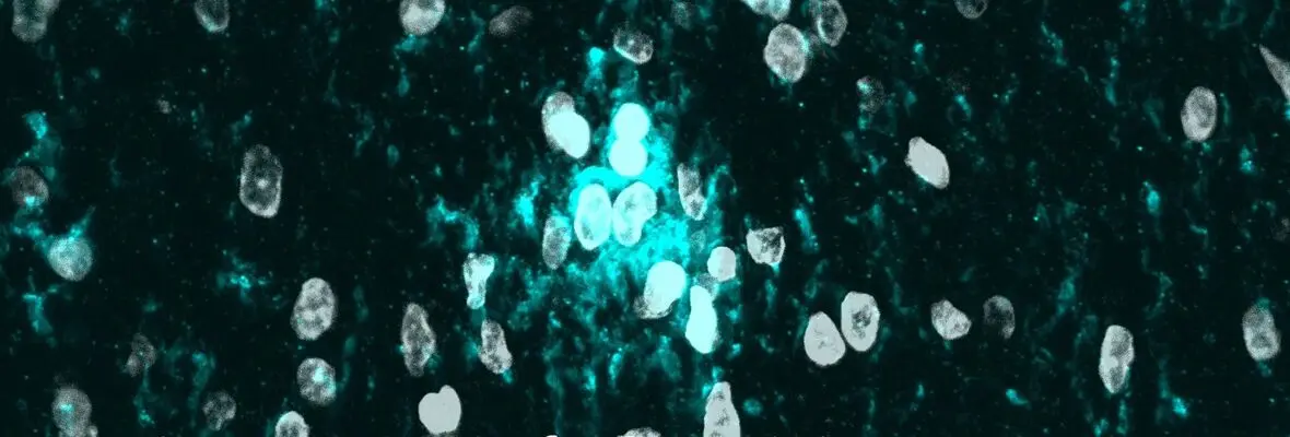 Cells within the brain that have undergone an experimental treatment to be repaired.