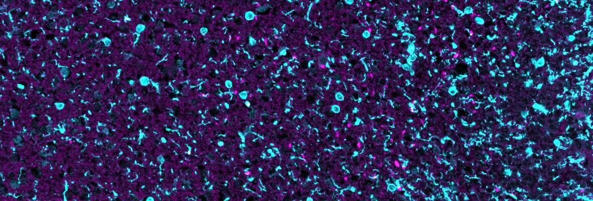 Observing brain cells under a microscope to track their interactions.